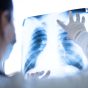 Pulmonologist,Looking,At,Lung,X-ray,Prescribing,Treatment,To,Patient,,Healthcare